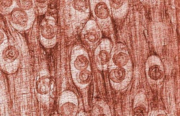 Trichineloza ucide! Porcul nu prezintă semne de boală, iar examinarea cărnii e obligatorie!